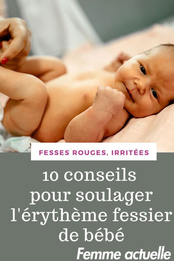 érythème fessier
