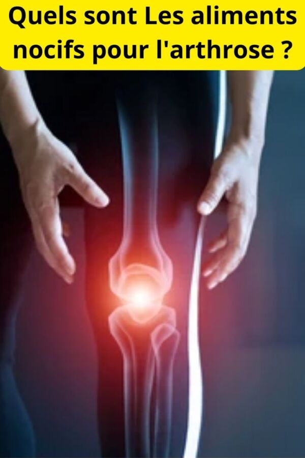 solution arthrose naturelle